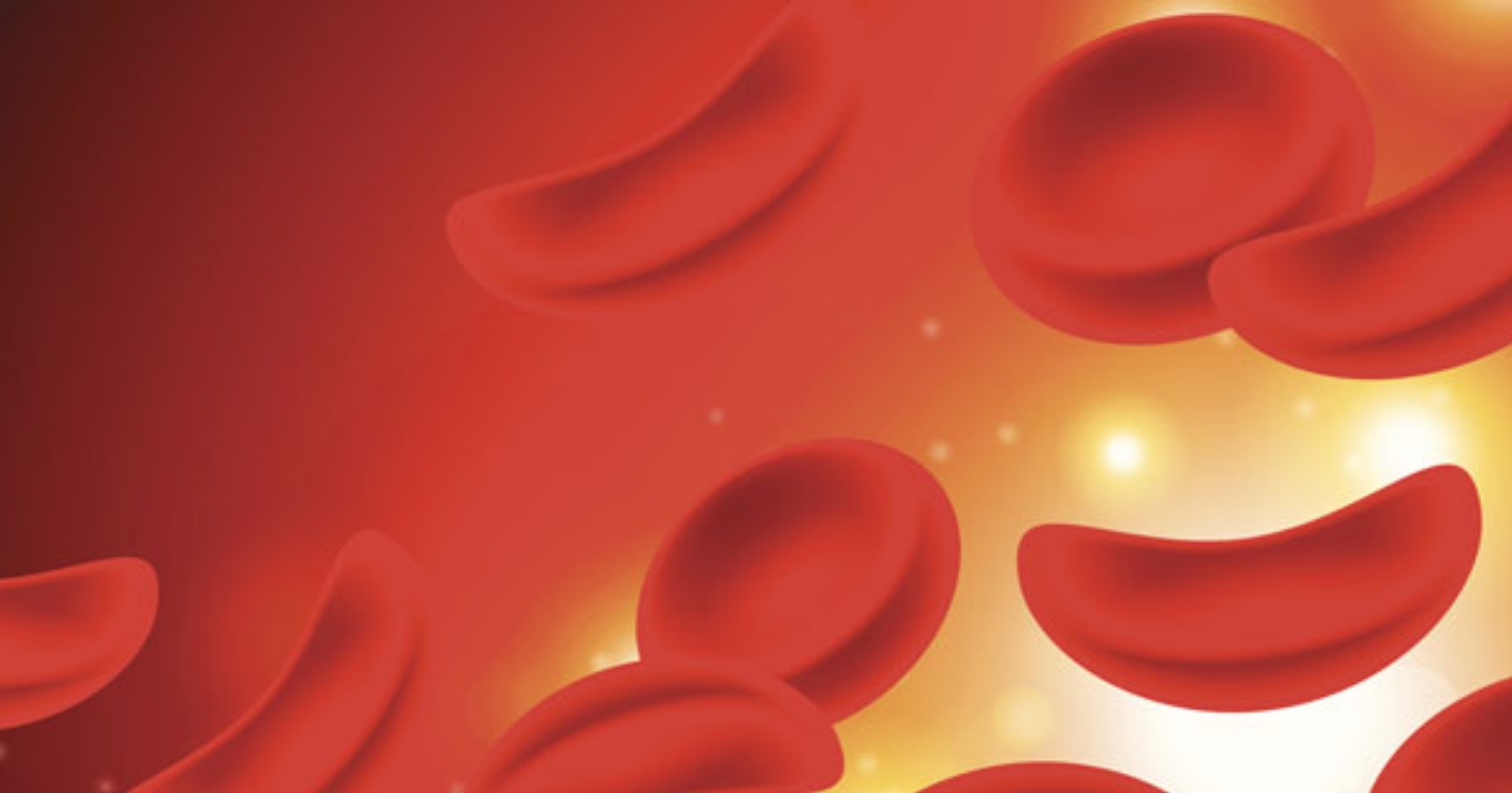 Sickle Cell Diseases